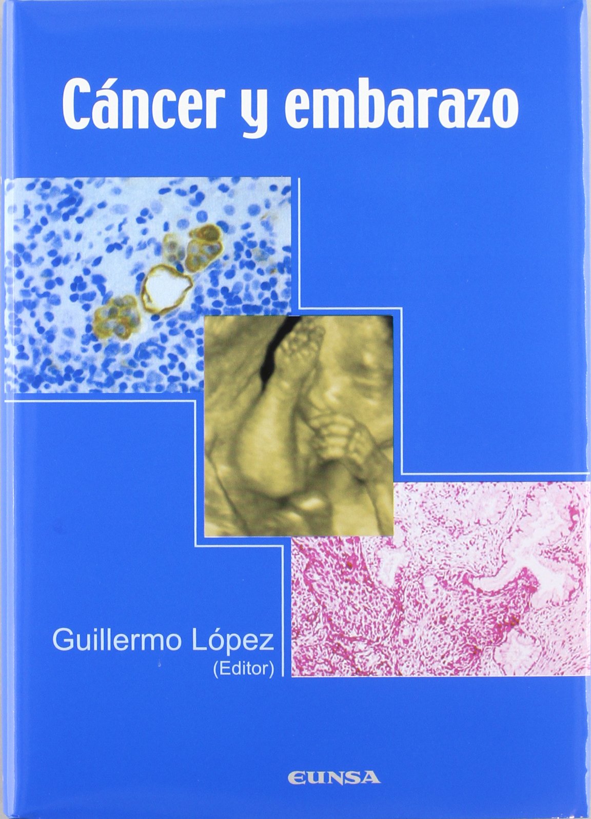 Cáncer y embarazo : actas del symposium celebrado en Pamplona (Navarra), los días 23 y 24 de marzo de 2006 (Libros de medicina) Medicine