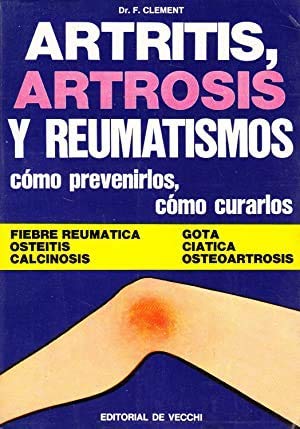 Artritis, artrosis y reumatismos: cómo prevenirlos, cómo curarlos book
