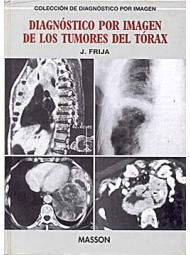 Diagnostico por imagen tumores torax book