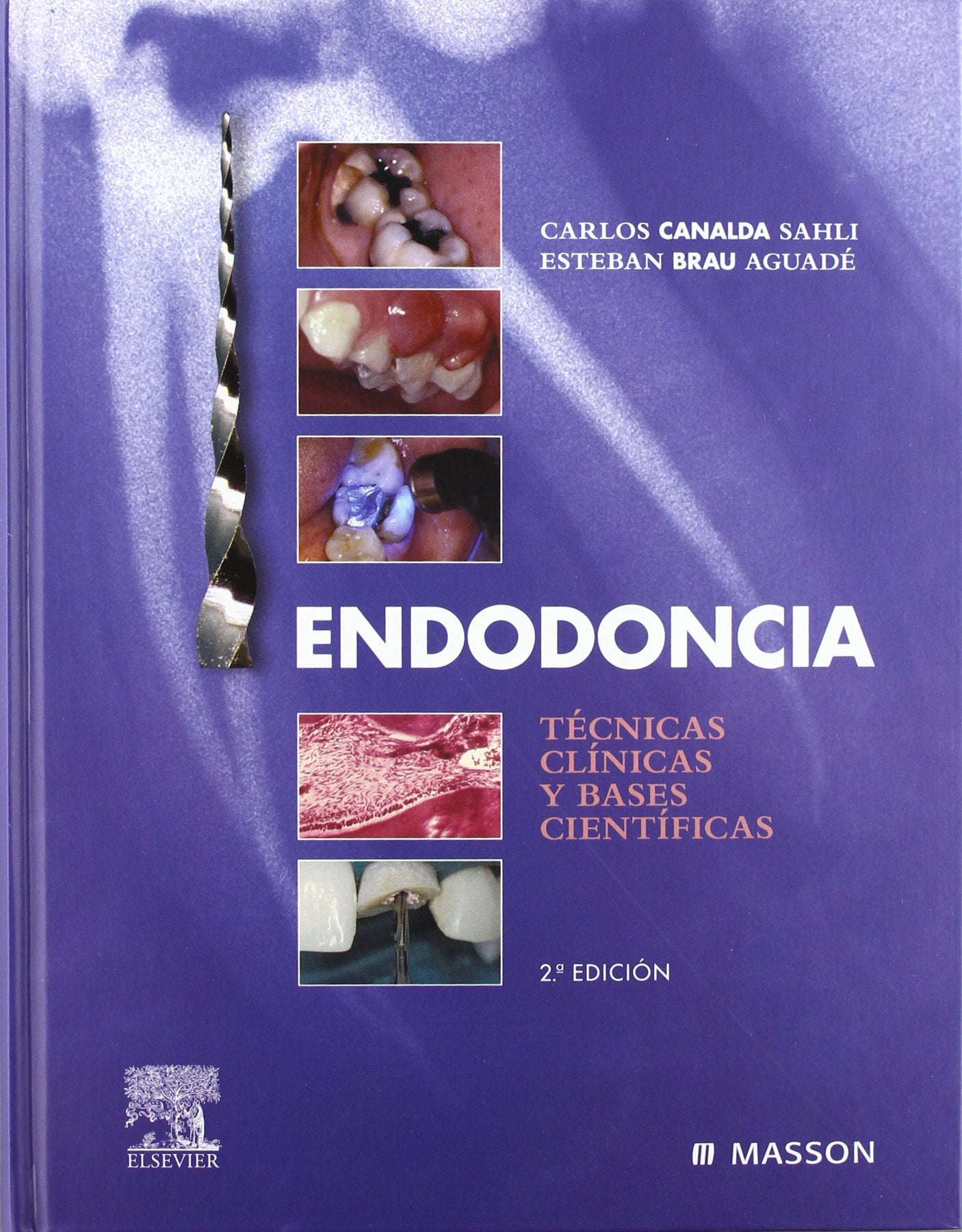 Endodoncia : técnicas clínicas y bases científicas Medicine