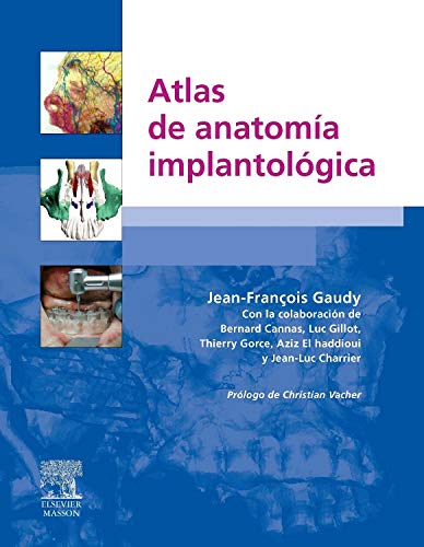 Atlas de anatomía implantológica book
