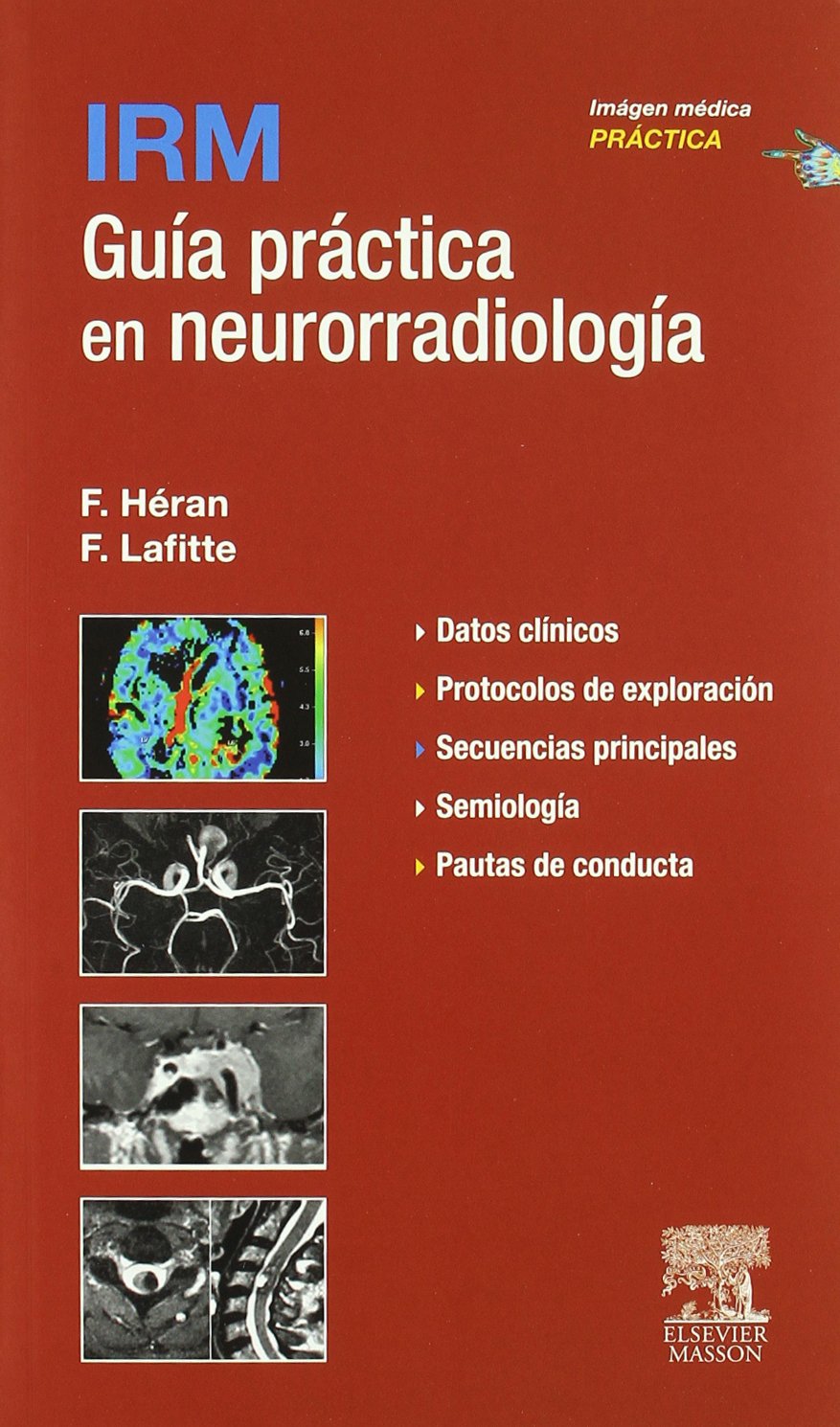 IRM, guía práctica en neurorradiología book