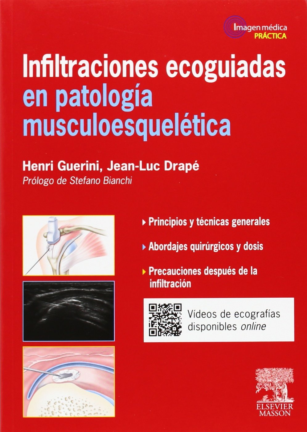 Infiltraciones ecoguiadas en patología musculoesquelética book