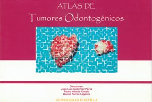 Atlas de tumores odontogénicos (Manuales Universitarios, Band 67) Books