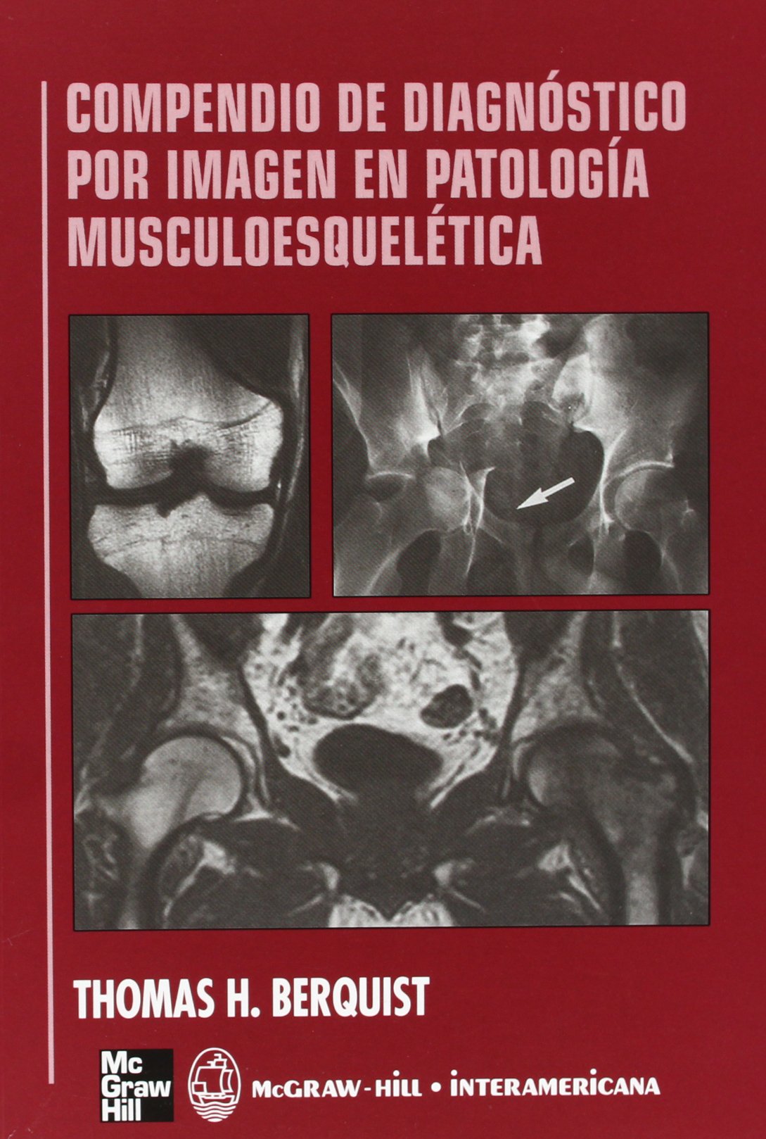 Compendio de diagnóstico por imagen en patología musculoesquelética book