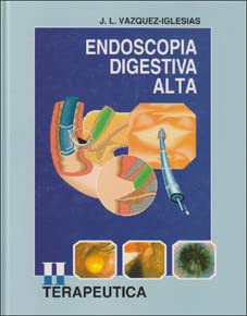 Endoscopia digestiva alta, terapeutica book