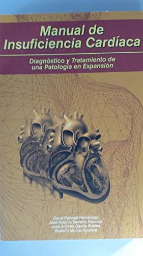 Manual de insuficiencia cardíaca book
