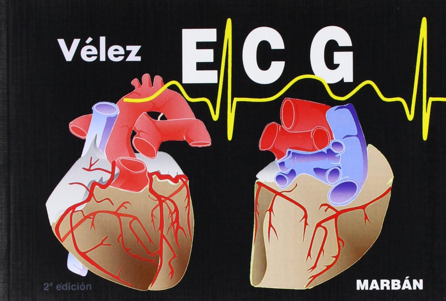 ECG, pautas de electrocardiografía Medicine