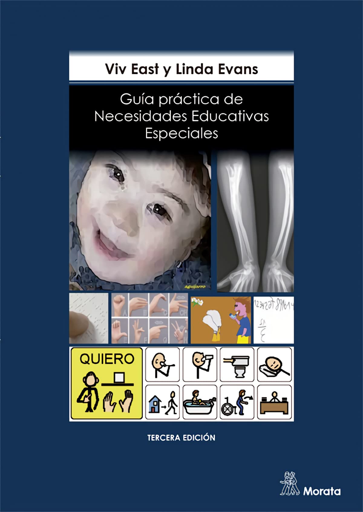 Guía práctica de necesidades educativas especiales book