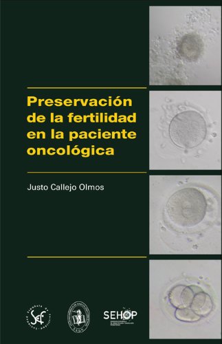 Preservación de la fertilidad en la paciente oncológica (Spanish Edition) Books