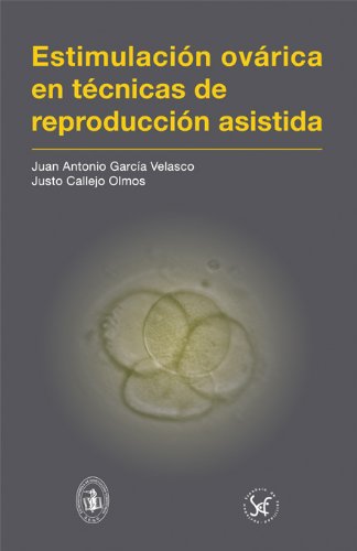 Estimulación ovárica en técnicas de reproducción asistida (Spanish Edition) Books