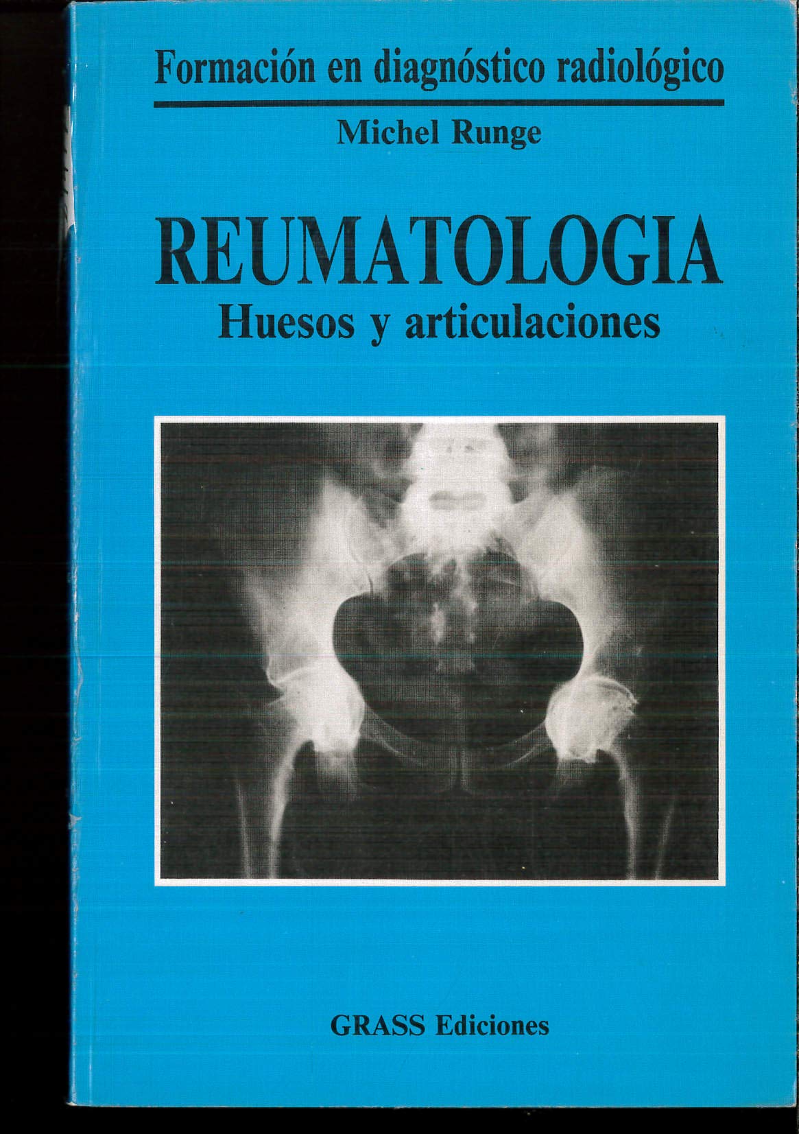 Reumatología: huesos y articulaciones book