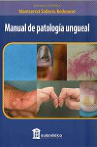 Manual de Patología Ungueal Books