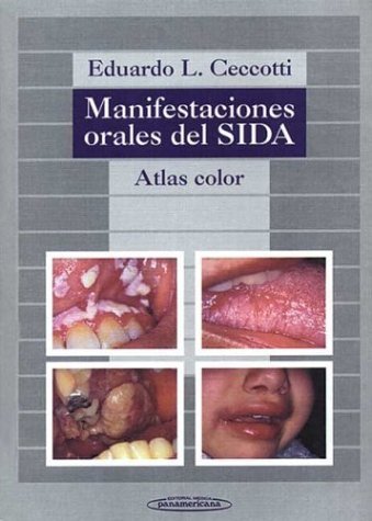 Manifestaciones orales del SIDA : atlas color Books