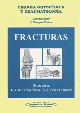 Fracturas Medicine