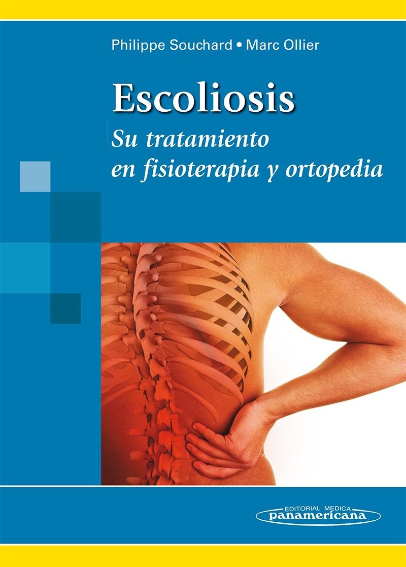 Escoliosis: Tratamiento Fisioterapia Y Ortopedia book