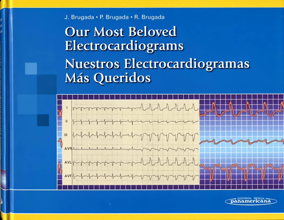 Our most beloved electrocardiograms = Nuestros electrocardiogramas más que Medicine