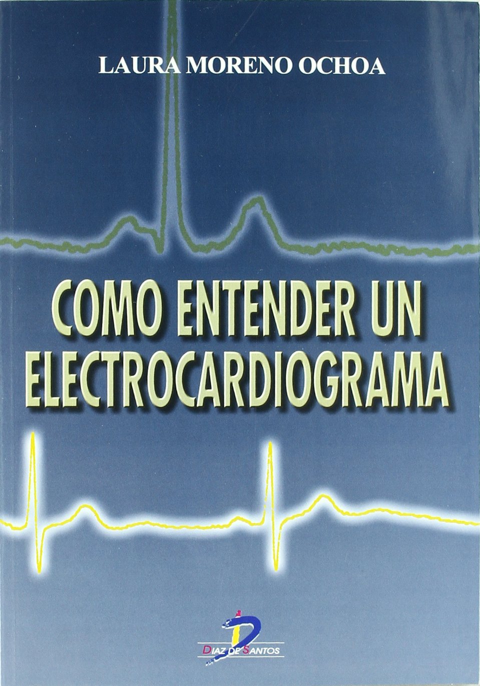 Cómo entender un electrocardiograma Medicine