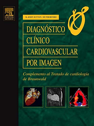 Diagnóstico clínico cardiovascular por imagen : complemento al tratado de cardiología de Braunwald Medicine