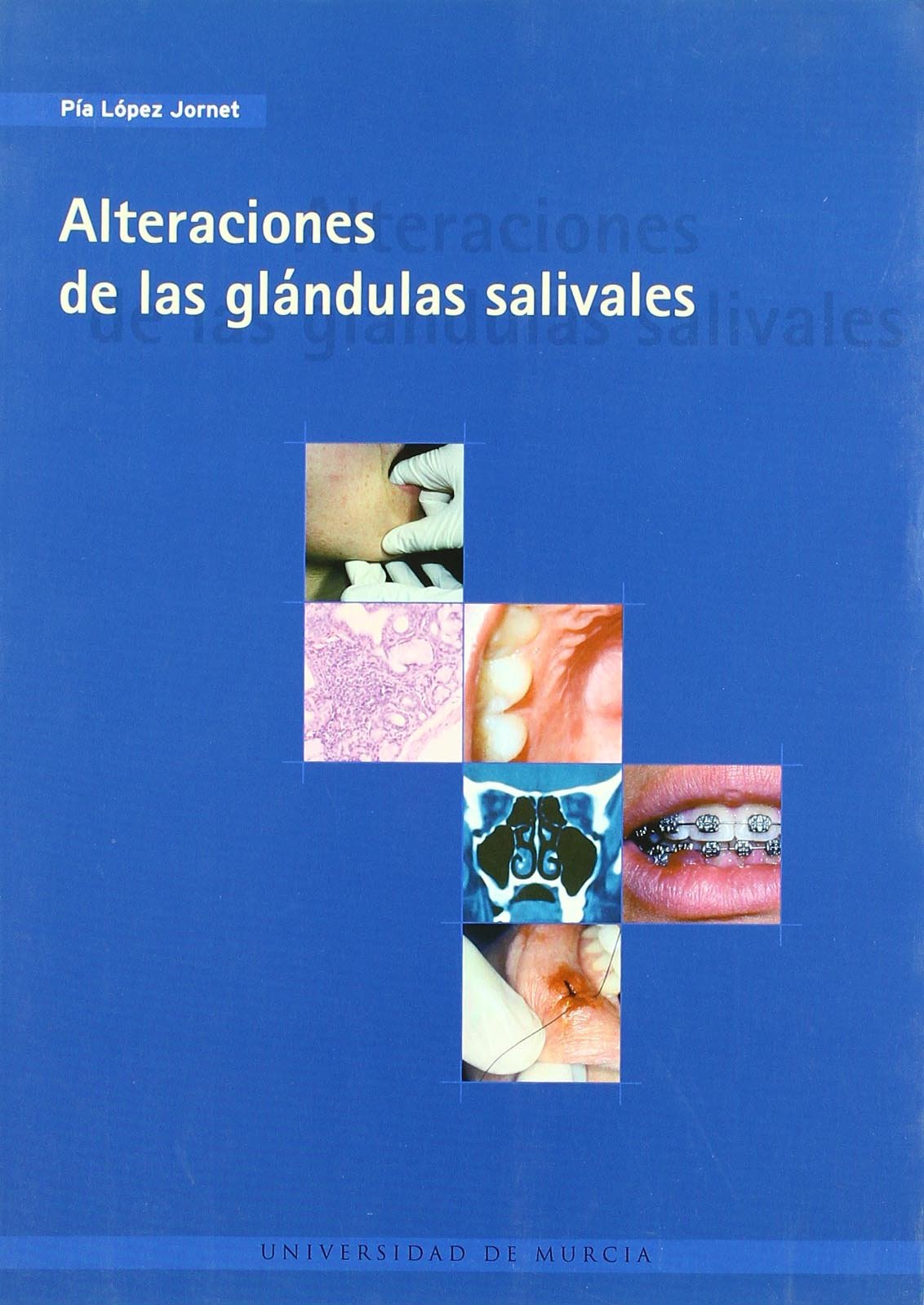 Alteraciones de las glándulas salivales book