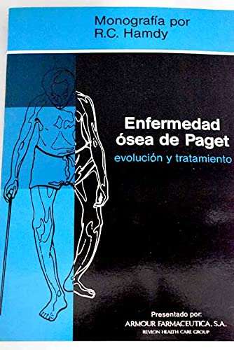 Enfermedad ósea de Paget: evolución y tratamiento : monografía Books