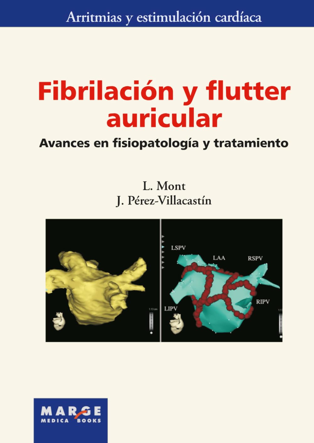 Fibrilación y flutter auricular Medicine