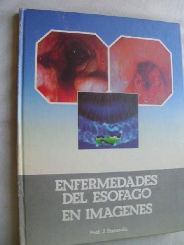 Enfermedades del esófago en imágenes. (Módulo 1) book