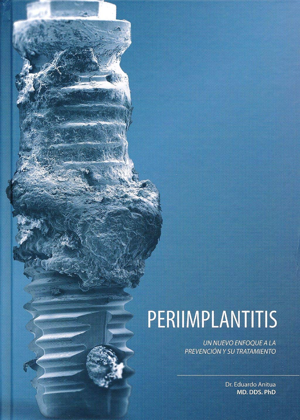 Periimplantitis: Un nuevo enfoque a la prevención y su tratamiento Books