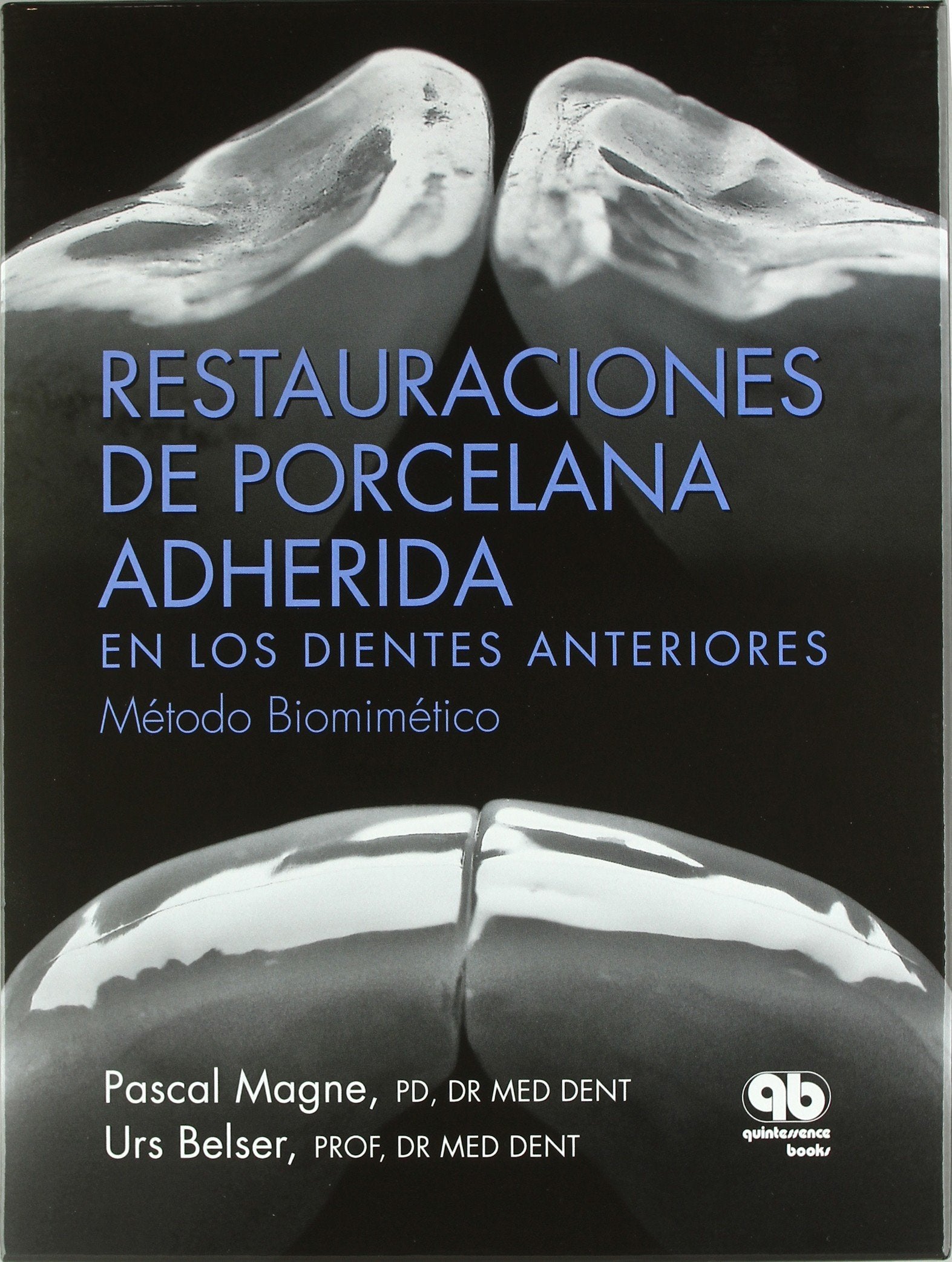 Restauraciones de Porcelana Adherida en los Dientes Anteriores: Un Enfoque Biomimético book