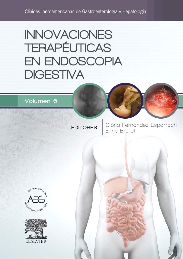 Innovaciones terapéuticas en endoscopia digestiva : clínicas iberoamericanas de gastroenterología y hepatología: Clínicas Iberoamericanas de Gastroenterología y Hepatología vol. 6 Medicine