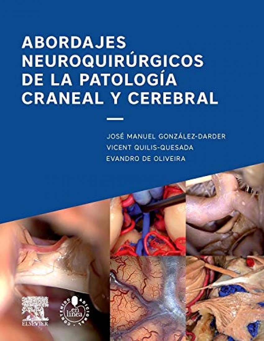 Abordajes neuroquirúrgicos de la patología craneal y cerebral Medicine