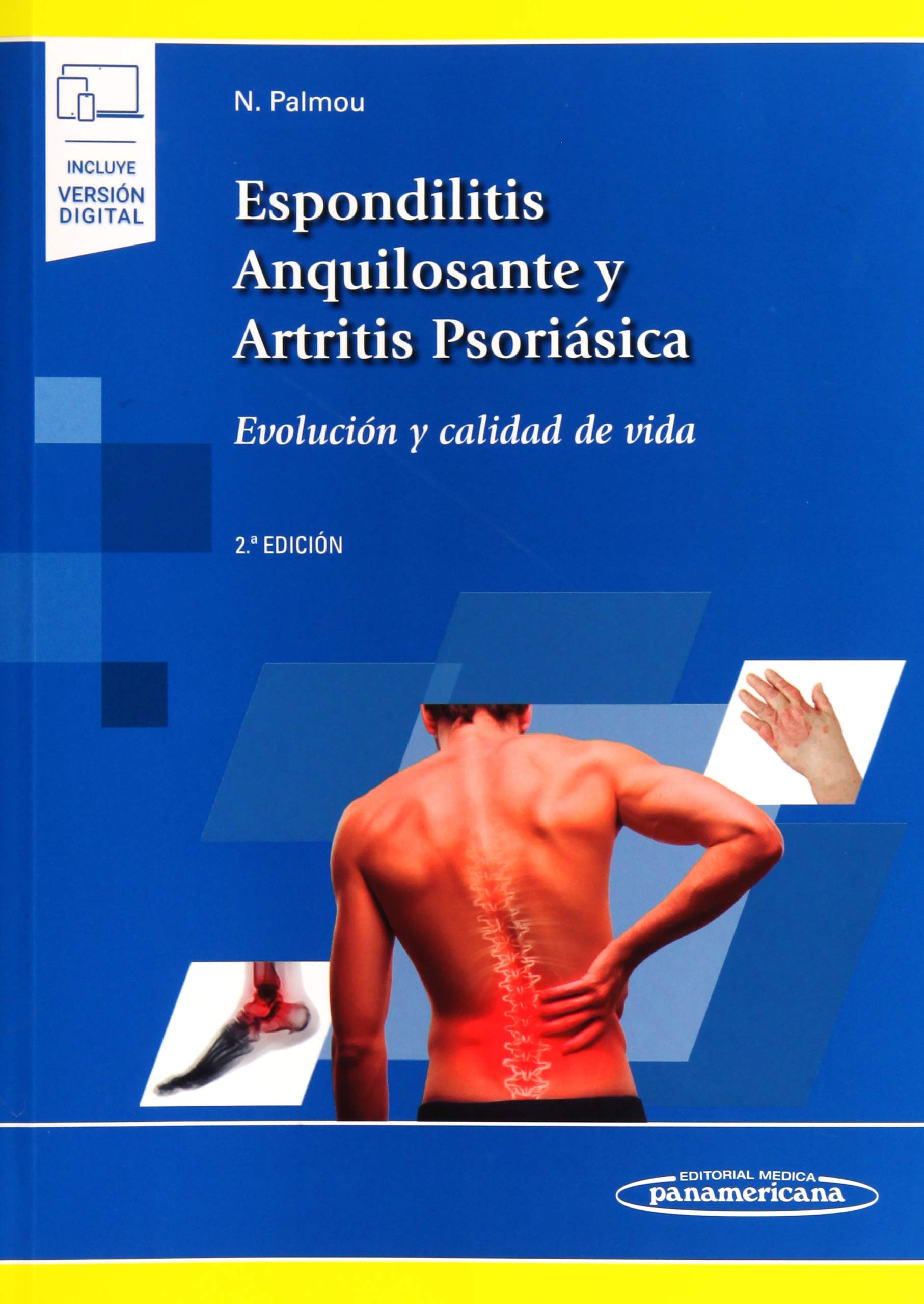 Espondilitis Anquilosante y Artritis Psoriásica: Evolución y calidad de vida Medicine