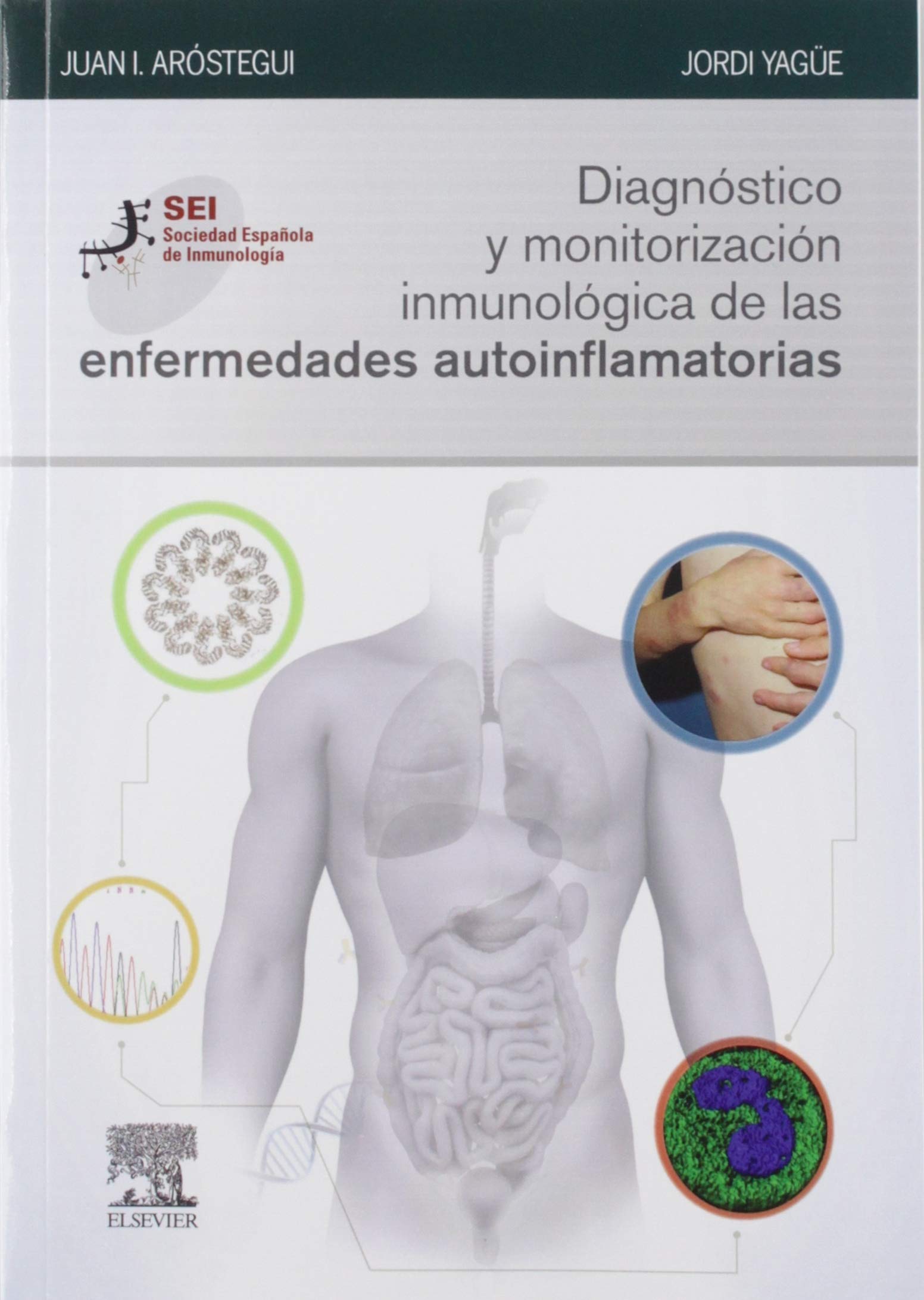 Diagnóstico y monitorización inmunológica de las enfermedades autoinflamatorias Medicine