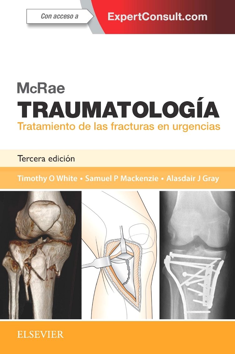 McRae. Traumatología. Tratamiento de las fracturas en urgencias + ExpertConsult (3ª ed.) book