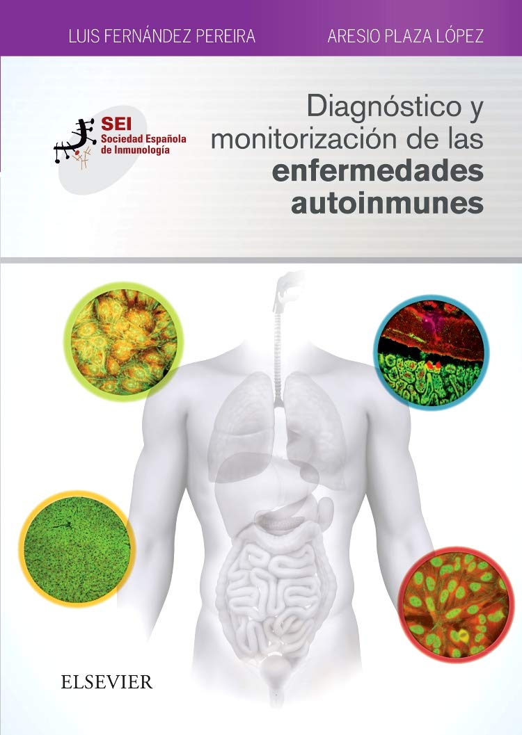 DIAGNOSTICO Y MONITORIZACION DE LAS ENFERMEDADES AUTOINMUNE: Sociedad Española de Inmunología Medicine