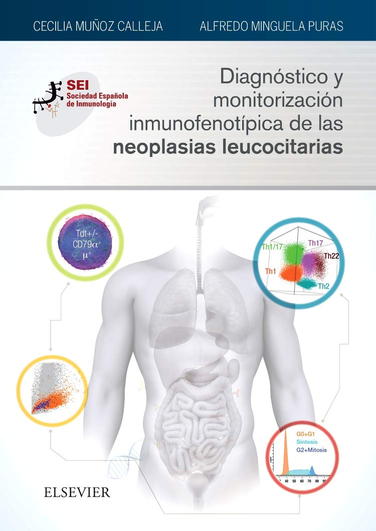 DIAGNÓSTICO Y MONITORIZACIÓN INMUNOFENOTÍPICA DE LAS NEOPLASIAS LEUCOCITARIAS: Sociedad Española de Inmunología Medicine