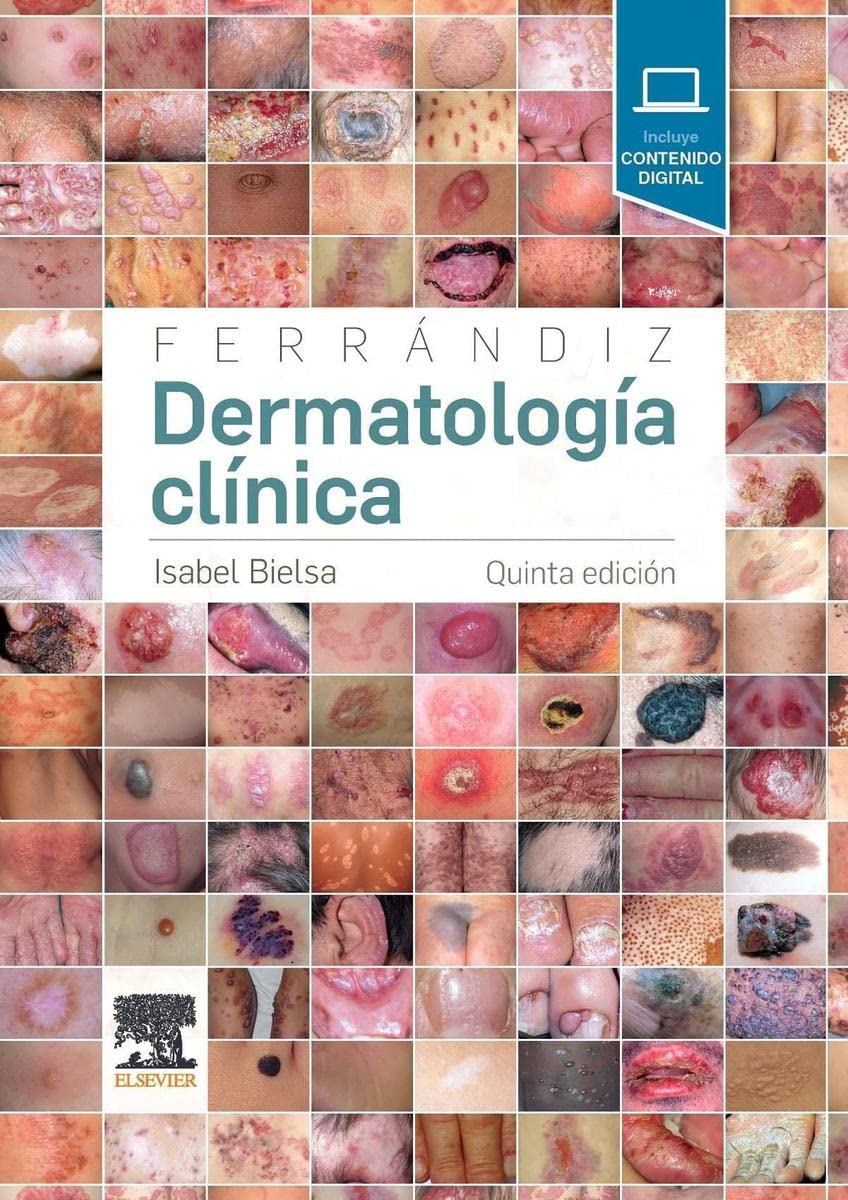 Ferrándiz. Dermatología clínica Medicine