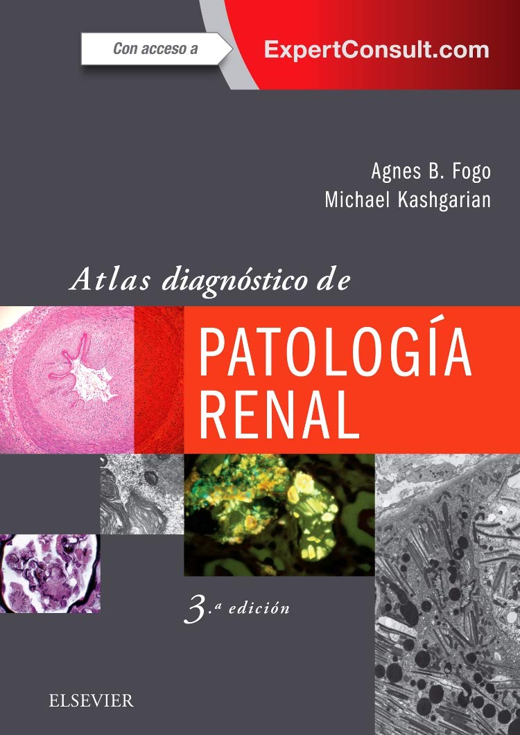 Atlas diagnóstico de patología renal + ExpertConsult (3ª ed.) Medicine