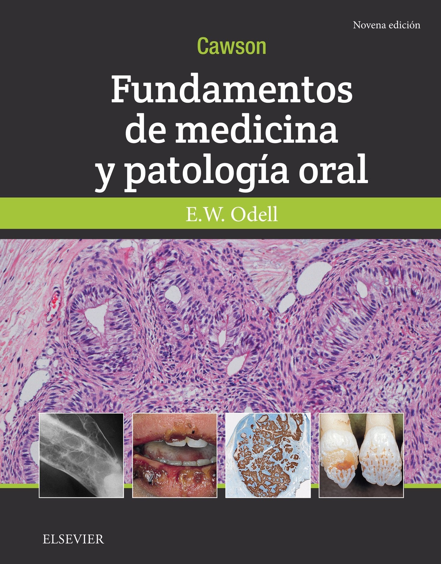 CAWSON FUNDAMENTOS DE MEDICINA Y PATOLOGIA ORAL 9ª ED Medicine