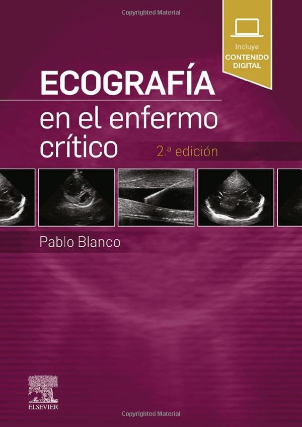 Ecograf�a en el enfermo cr�tico 2� Edici�n Books