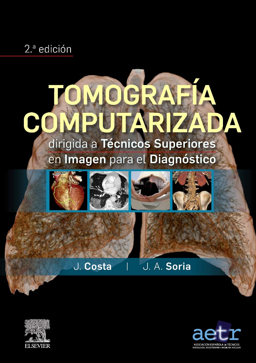 Tomografía computarizada dirigida a técnicos superiores en imagen para el diagnóstico Medicine