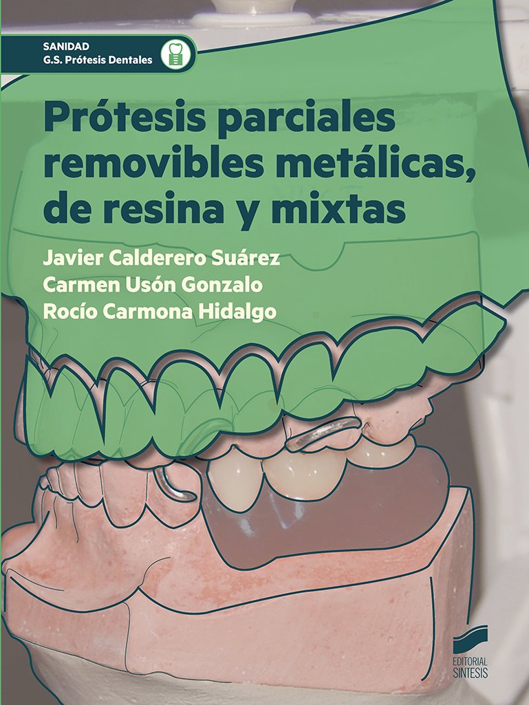 Prótesis parciales removibles metálicas, de resina y mixtas book