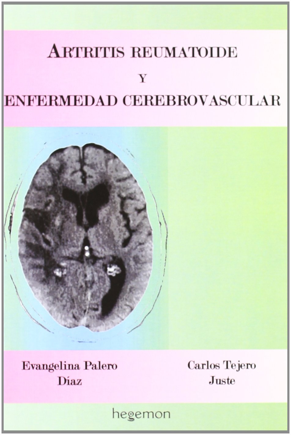 Artritis reumatoide y enfermedad cerebrovascular Books