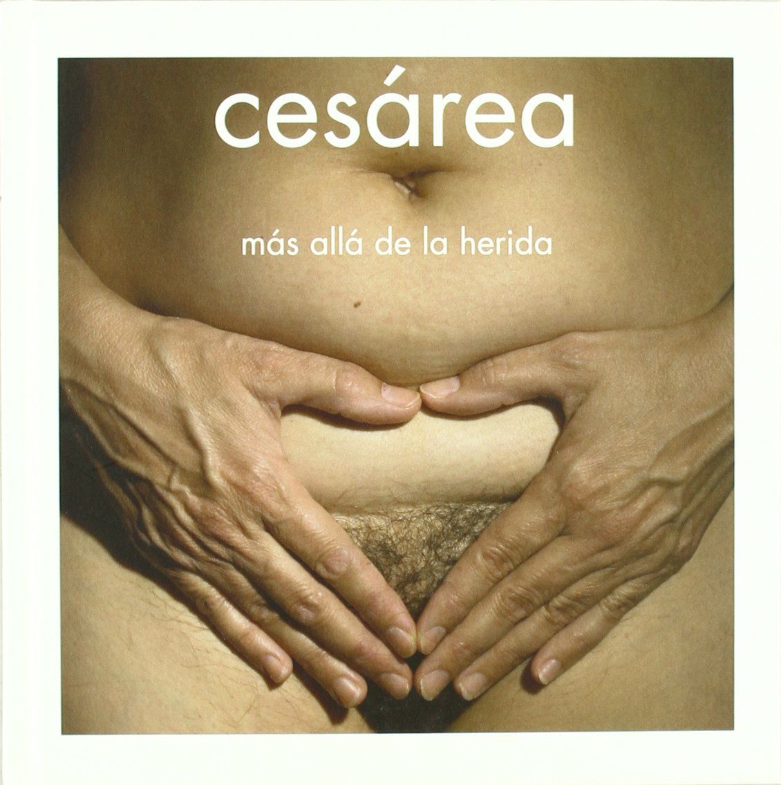 Cesárea : más allá de la herida Learning & Reference
