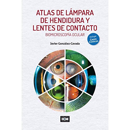 ATLAS DE LÁMPARA DE HENDIDURA Y LENTES DE CONTACTO book