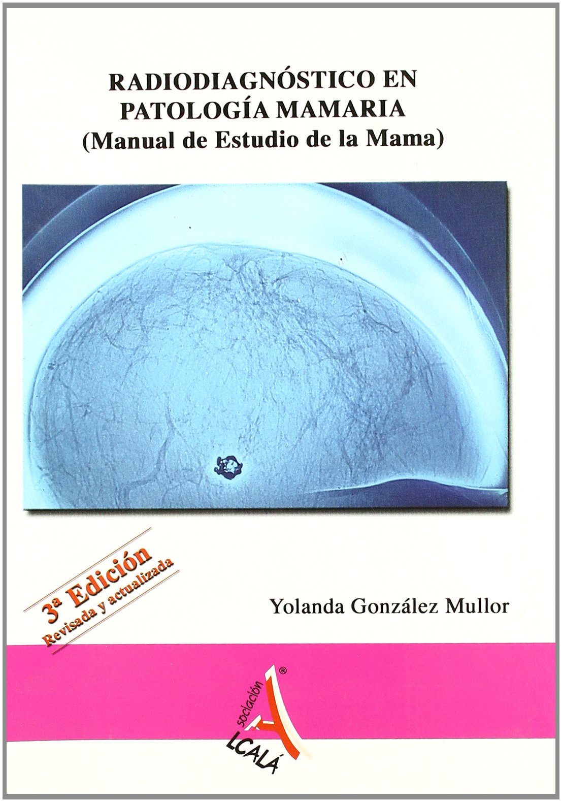 Radiodiagnóstico en patología mamaria (Ciencias sanitarias) Medicine