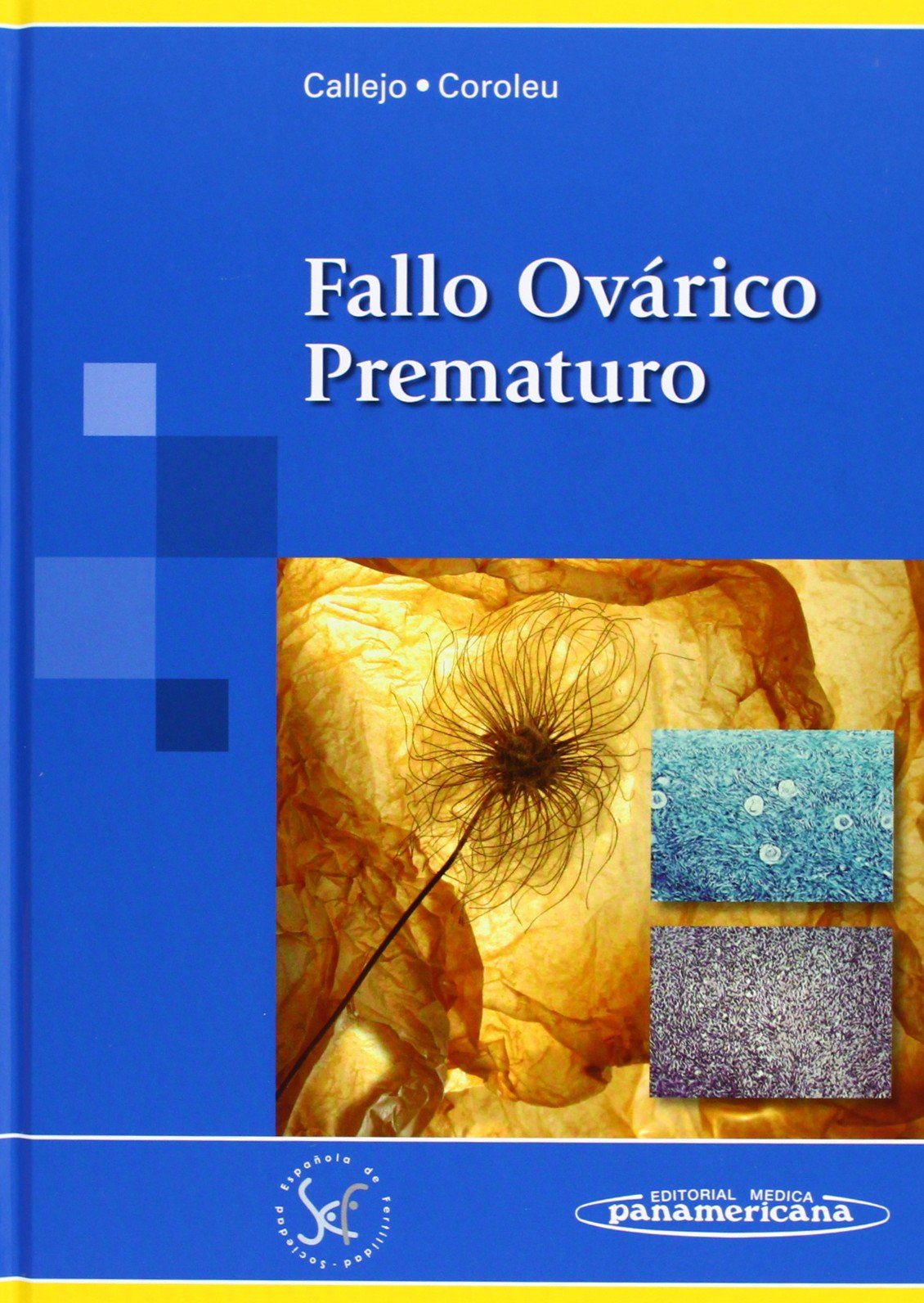 Fallo ovárico prematuro Medicine