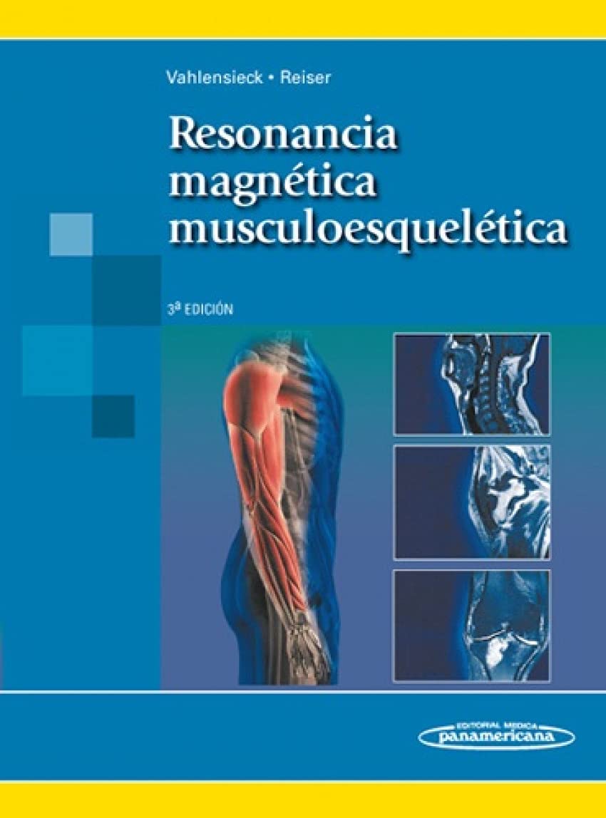 Resonancia magnética del aparato locomotor Medicine