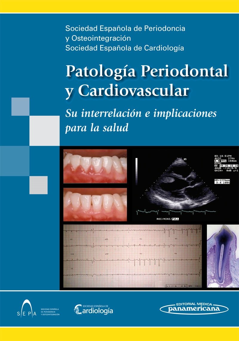 Patologia periodontal y cardiovascular: Su Interrelacion E Implicaciones Para La Salud book