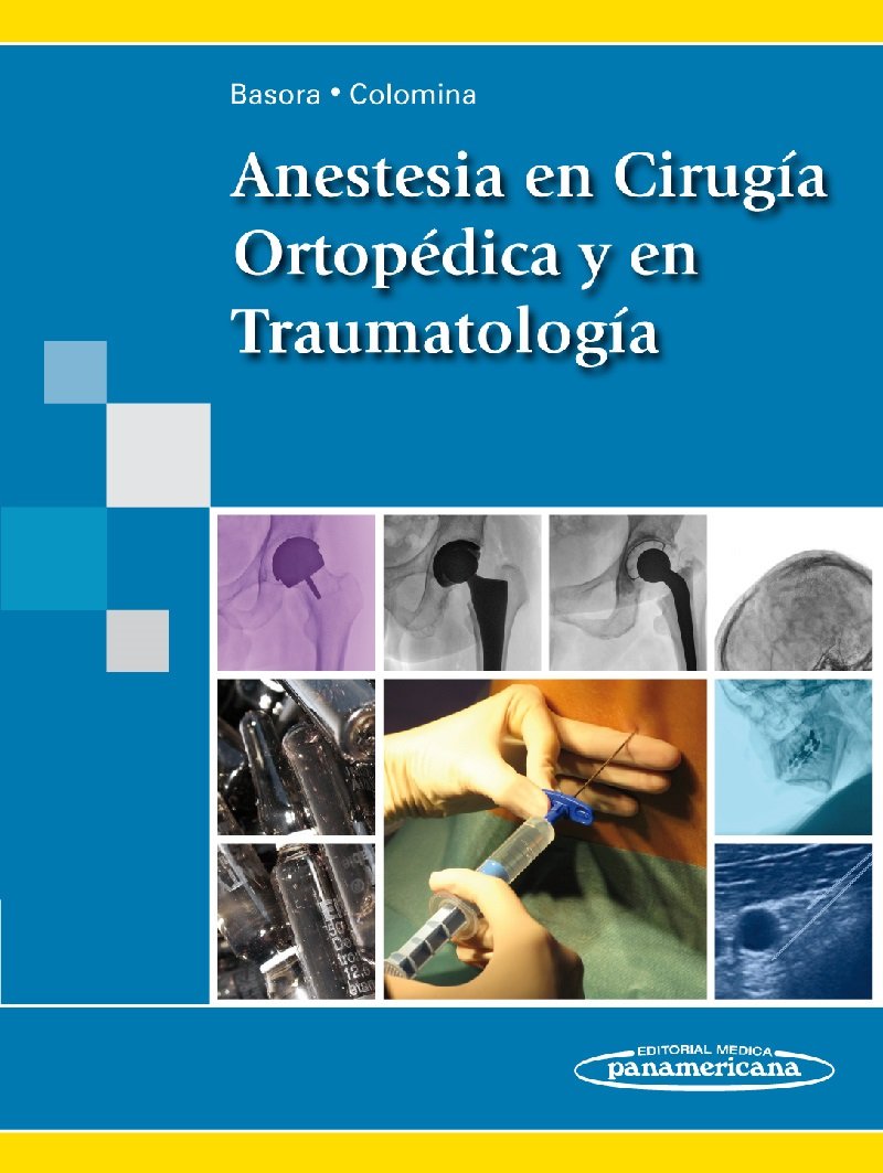 Anestesia en cirugía ortopédica y en traumatología Medicine